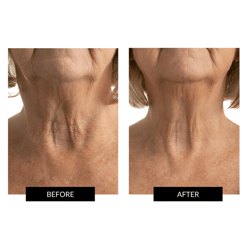 CurrentBody Ultimate Neck Care Kit
