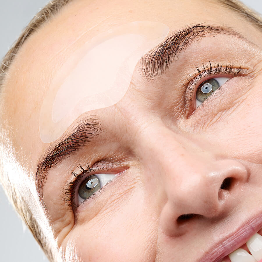 CurrentBody Skin RF Microneedling Treatment - Exclusive Offer